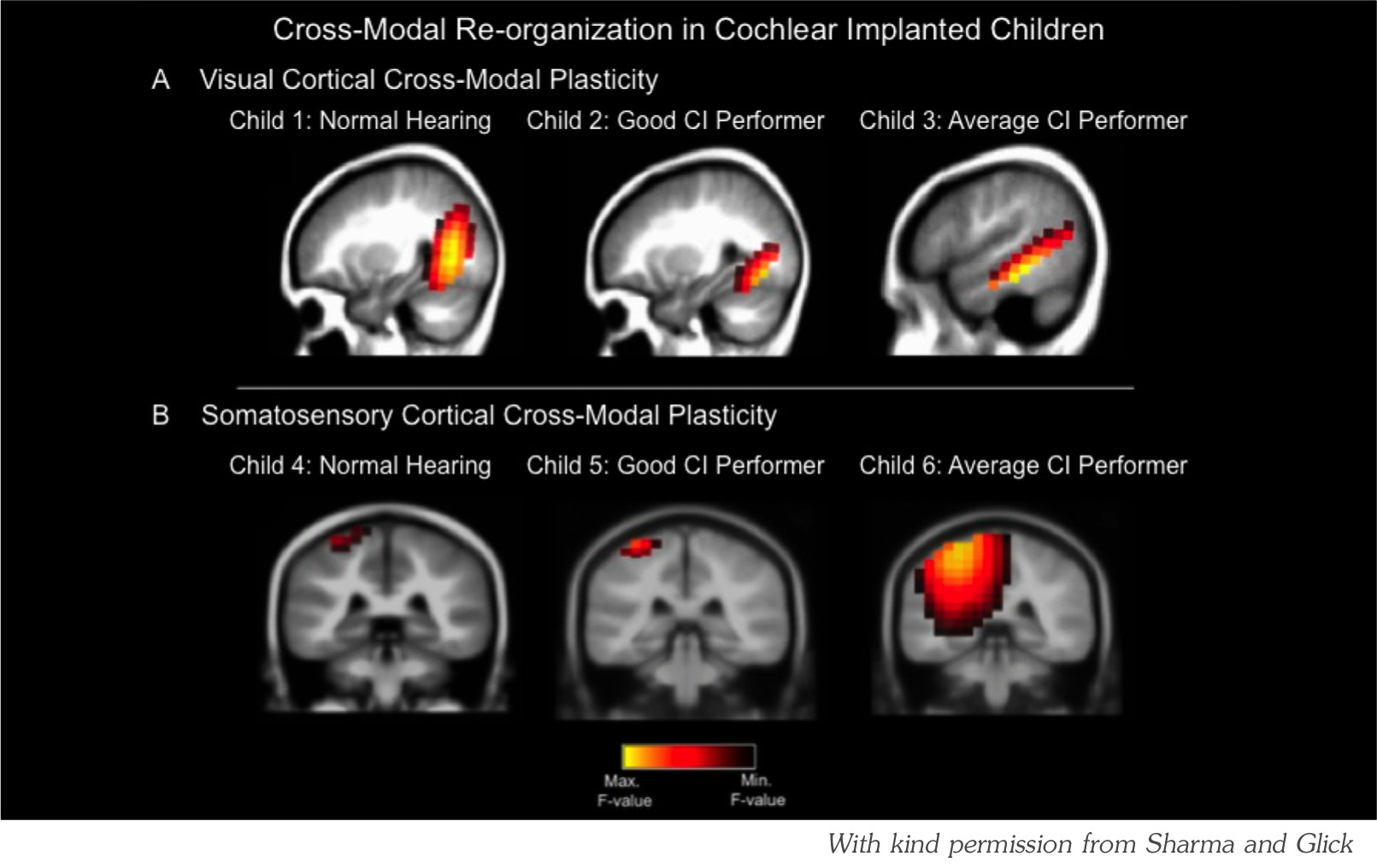 Brain Cross Modal | MESHGuides